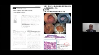 5分でわかる！】「胃と腸」レビュー動画 2024年 4月号（増大号